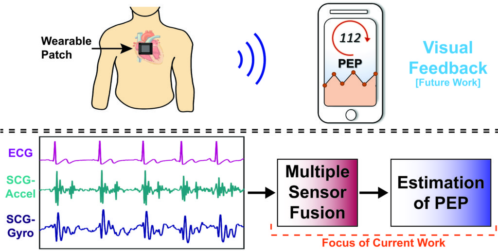 Wearable Sensor to Estimate Pre Ejection Period