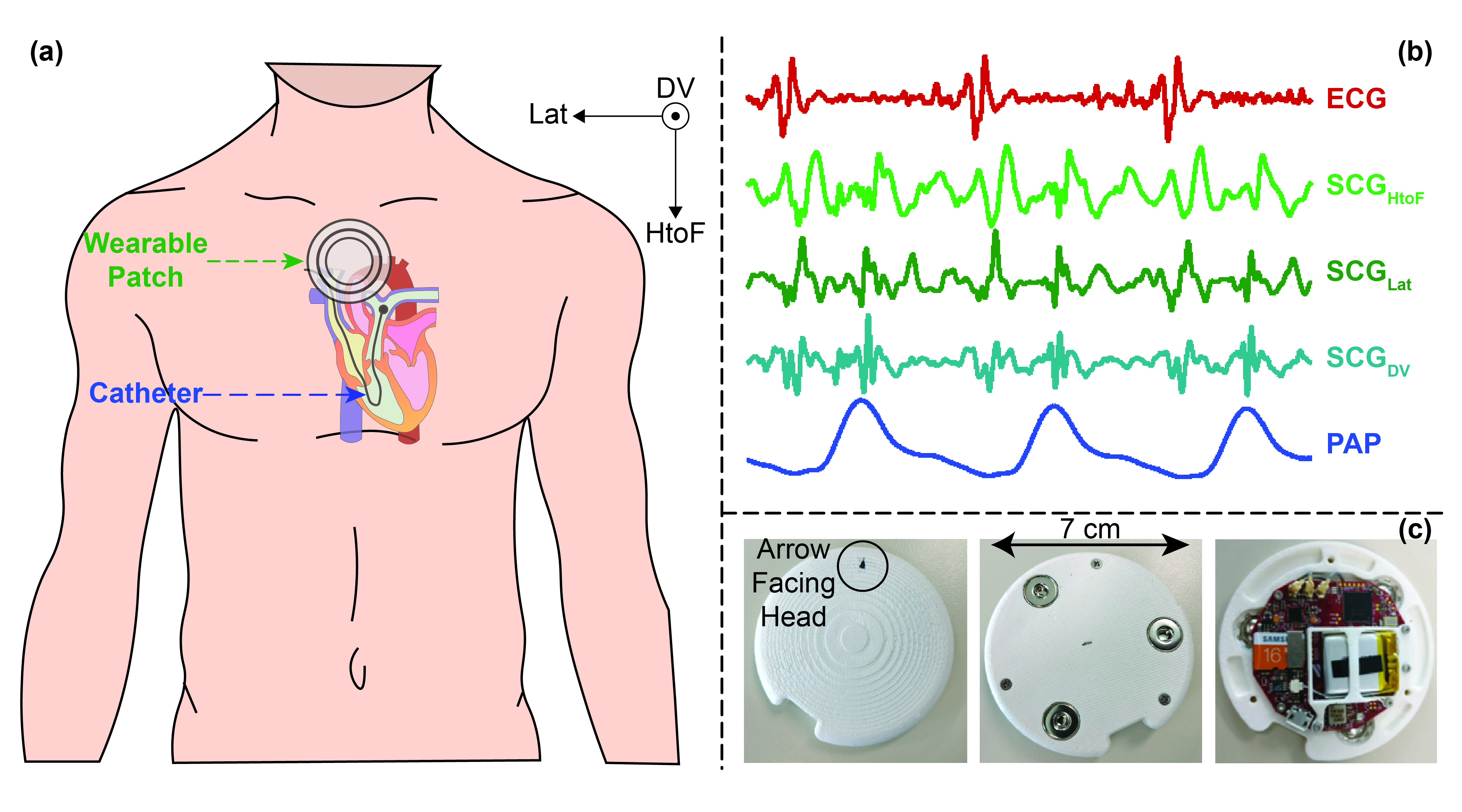 Wearable Biosensor to Estimate Changes in Hemodynamics